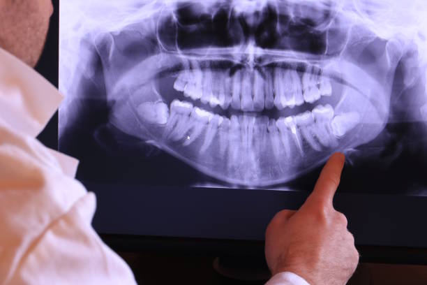 Best Emergency Dental Extractions in Faxon, PA
