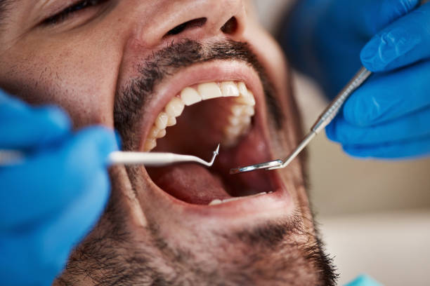 Best Emergency Dentist for Lost Fillings or Crowns in Faxon, PA