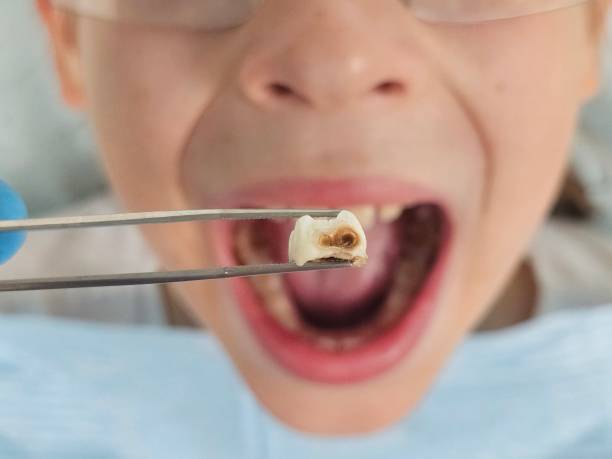 Best Pediatric Emergency Dentist in Faxon, PA